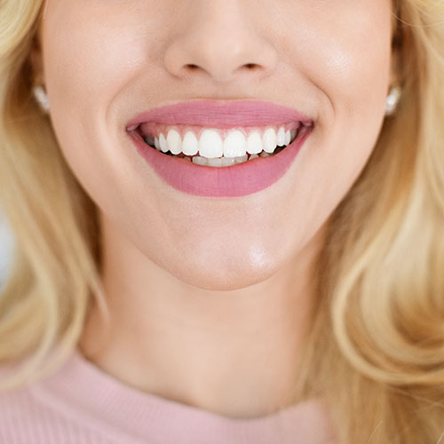 Teeth Whitening​ Cosmetic Dentistry in Coolalinga