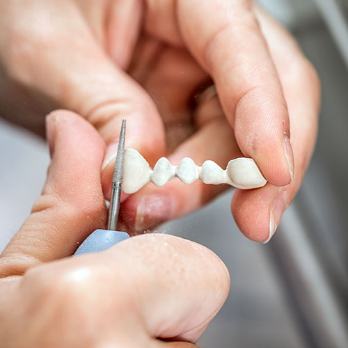 Dental Bridges​ Cosmetic Dentistry
