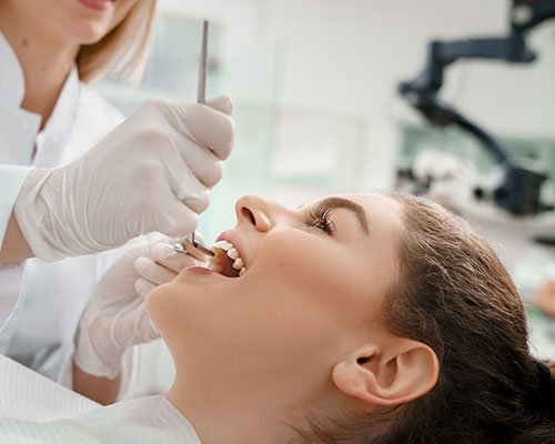 Beyond Teeth​ - teeth whitening