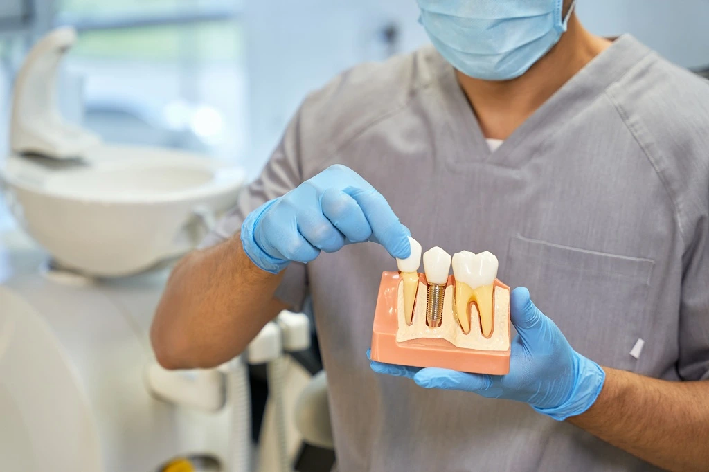 dental implant services in Darwin and northern territories