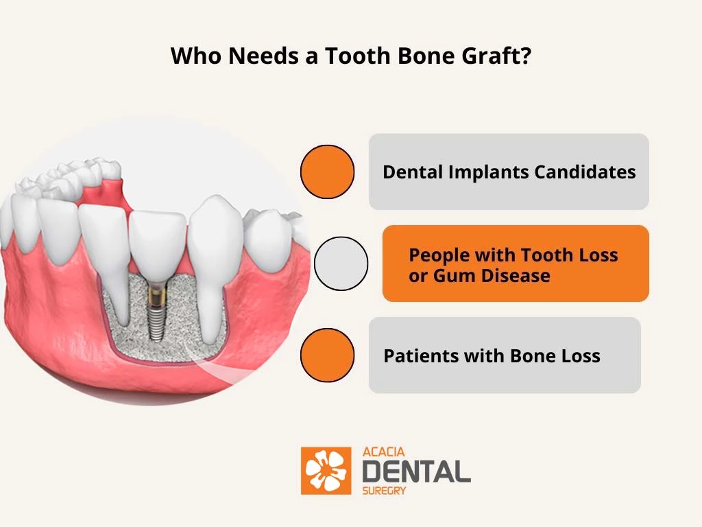 Who Needs a Tooth Bone Graft?