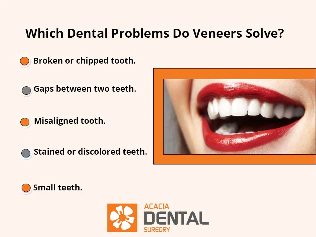 dental veneer use cases