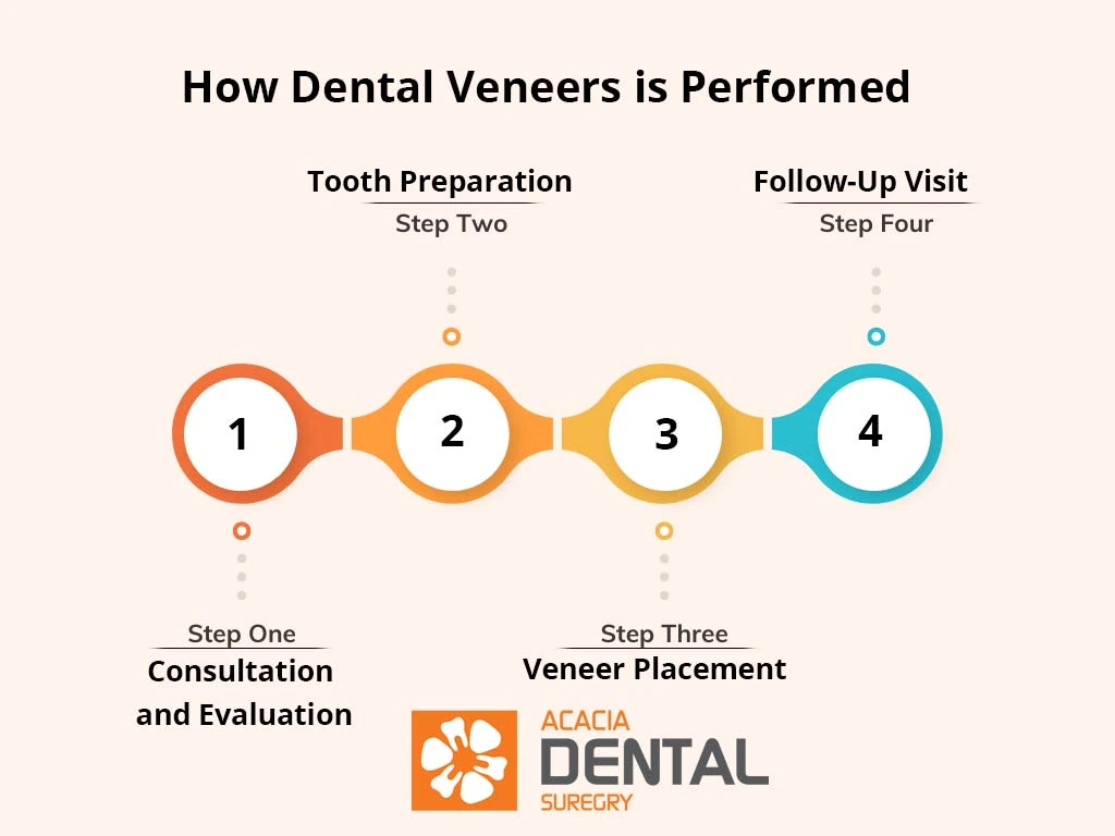 dental veneer procedure steps