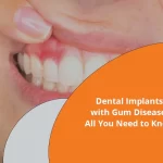 dental implants with gum disease