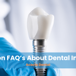Common FAQs About Dental Implants in Darwin