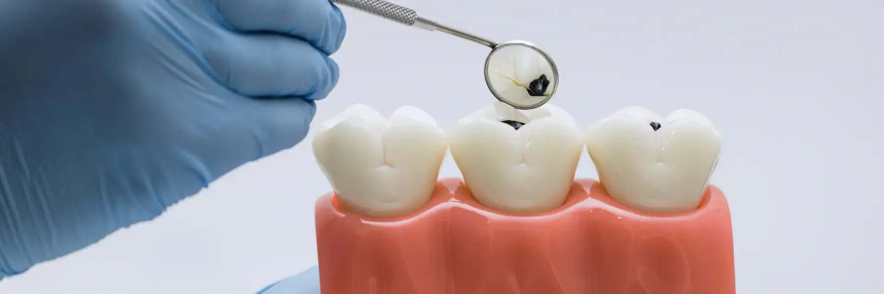 Cavity