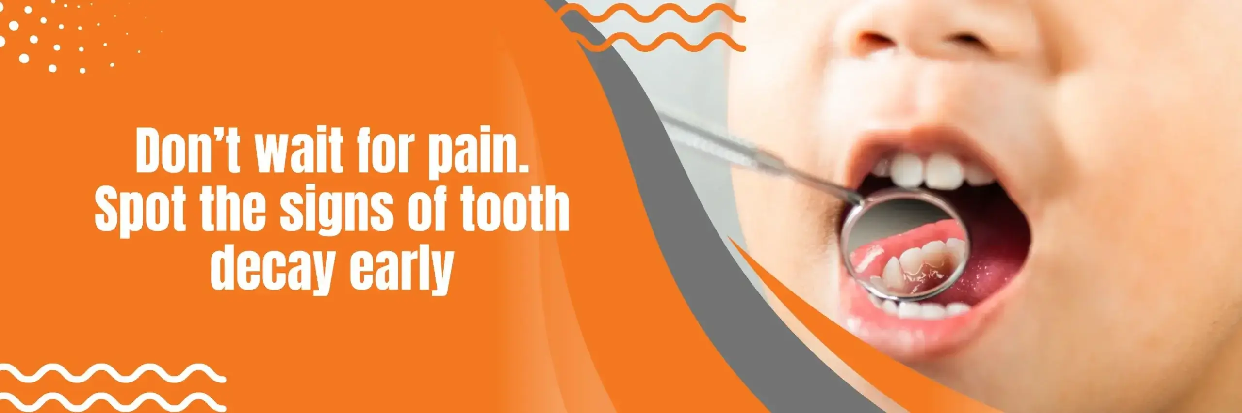 Spot the signs of Tooth Decay Early