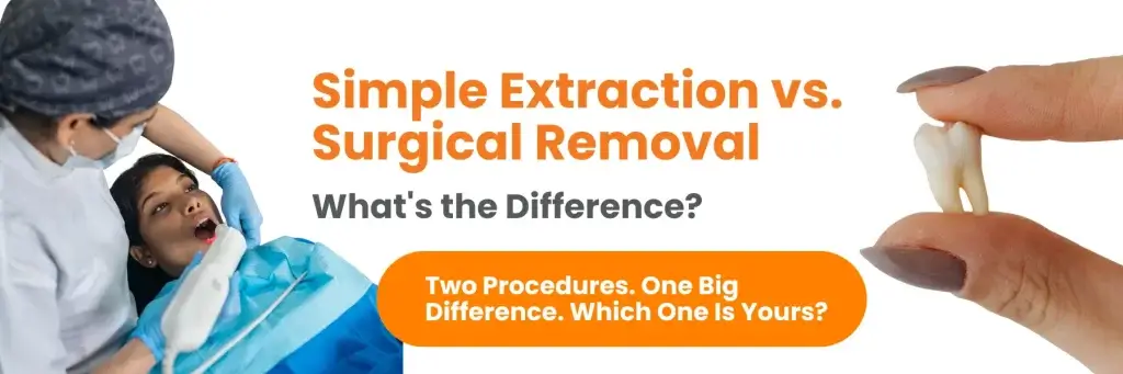 Simple Extraction vs. Surgical Removal - What's the Difference?