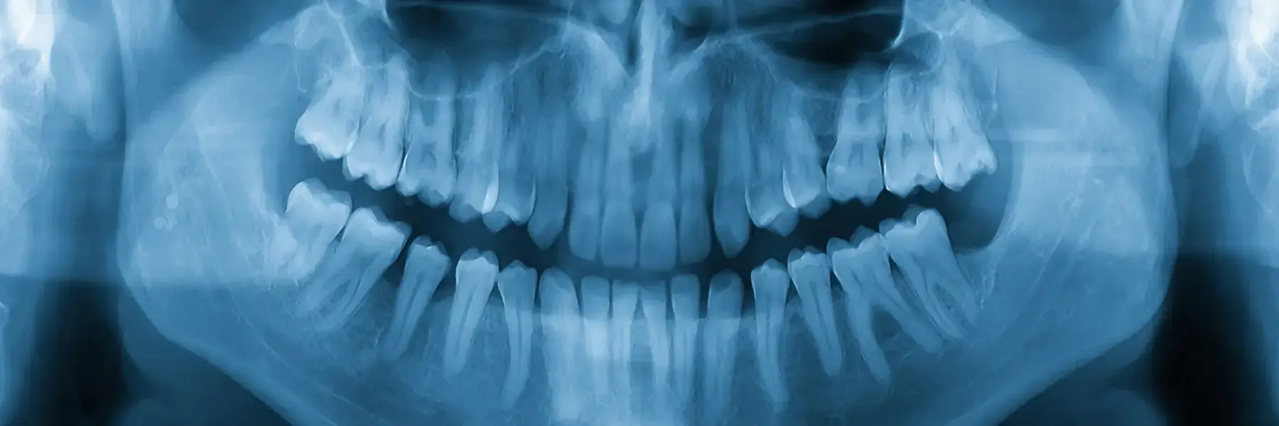 The Bone Health Issue