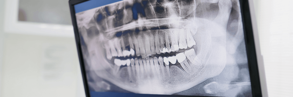Tooth anatomy diagram